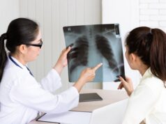 Fibrosis pulmonar: la falta de aire al caminar o subir escaleras no siempre es consecuencia de la edad